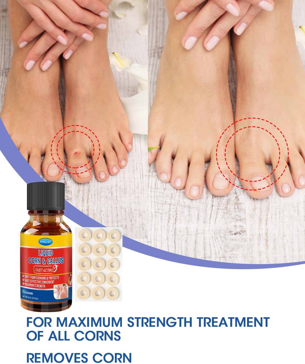 Liquid Corn Remover, Corn Removers for Toes, Fast Acting, Safe Removes Corns Fast Extra Strength for Kids and Adults, 15ml Liquid with 15PCS Cushions 10PCS Swabs (15ML*1)
